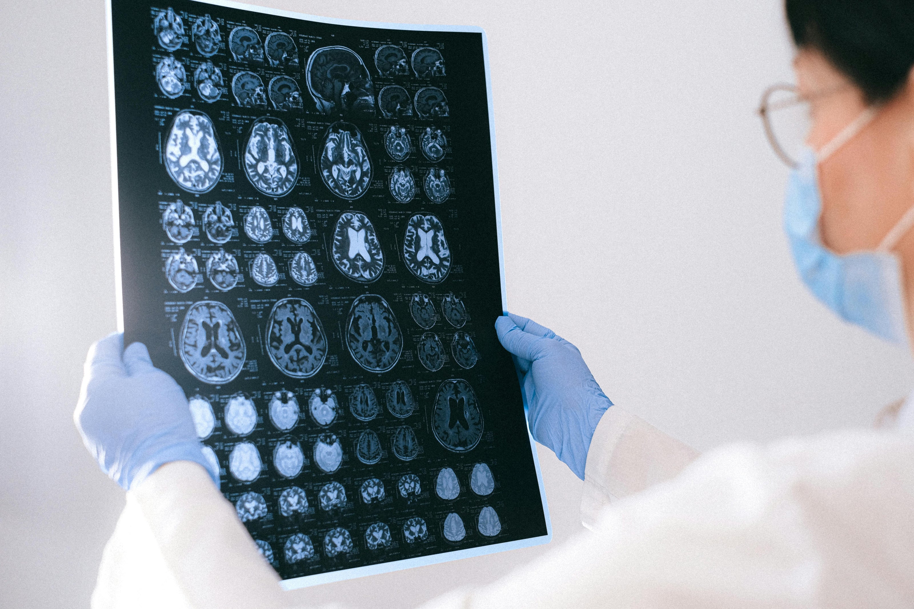 Medical professional wearing glove holding a scan image